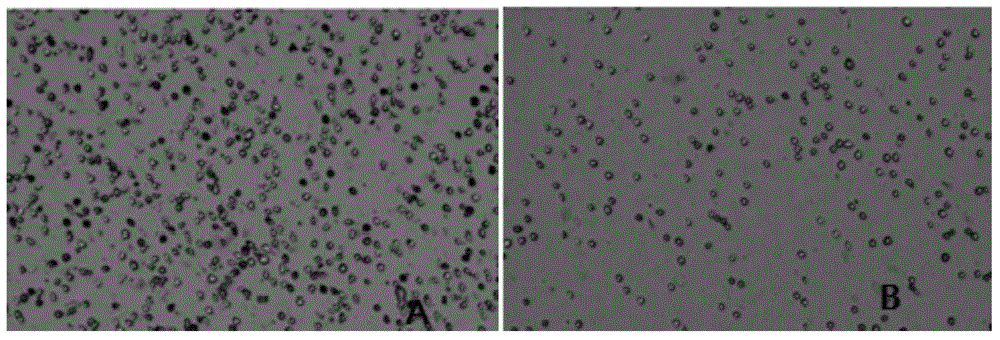 Primary isolation culture method of adipose-derived stem cells