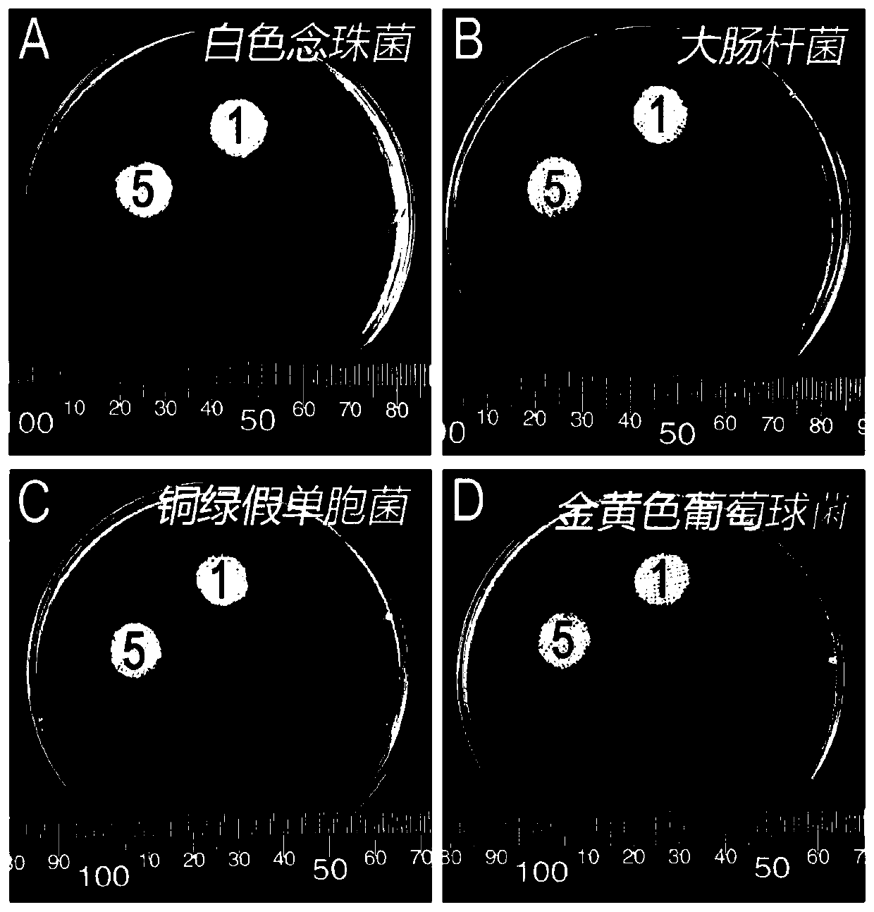 Preparation and application of antibacterial modified exosome burn wound healing-promoting biological dressing