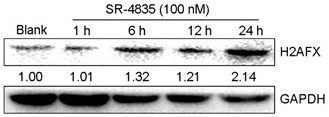 Screening reagent for detecting core molecules of DNA damage signal path and application of screening reagent