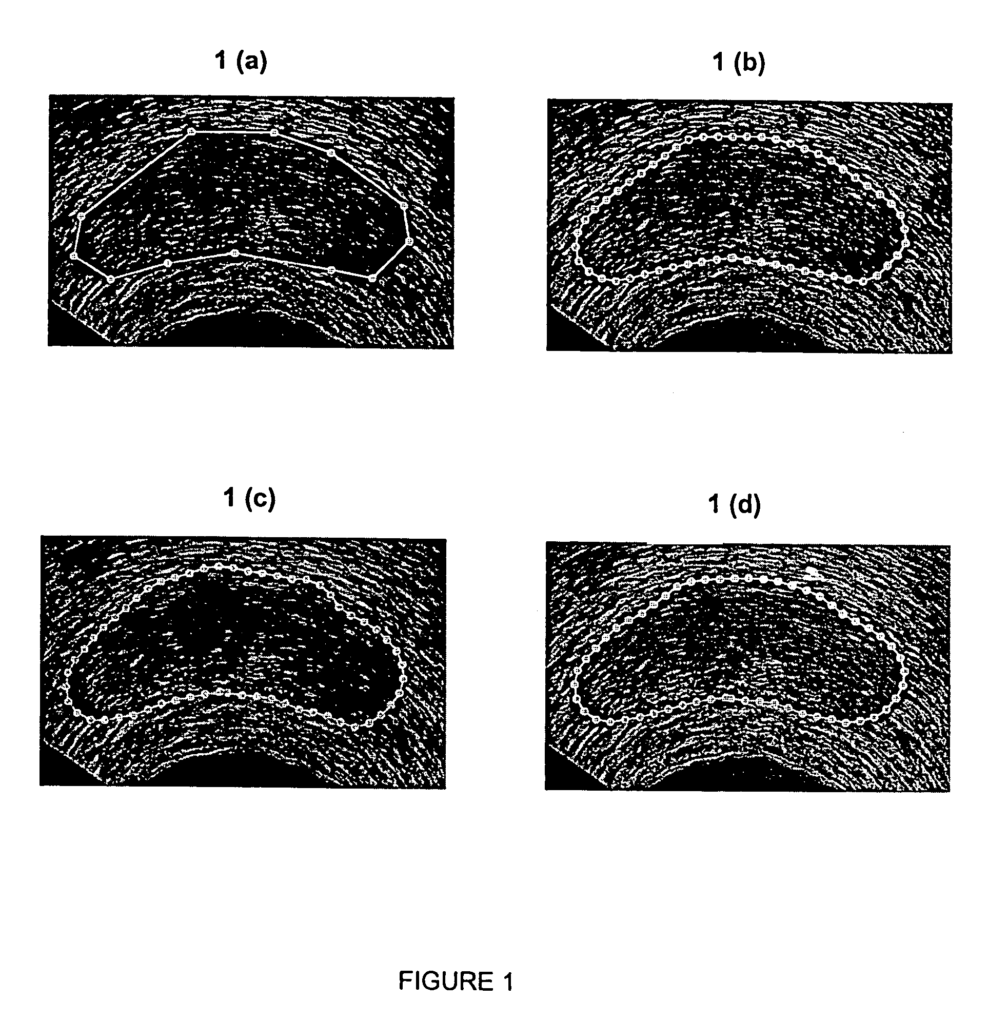 Prostate boundary segmentation from 2D and 3D ultrasound images