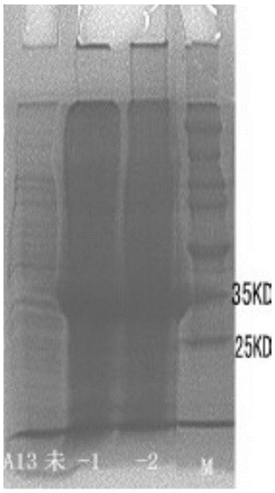 Detection test paper for forest encephalitis antibody, test paper preparation method and detection kit