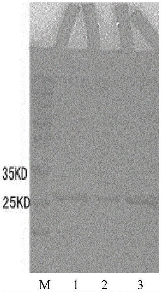 Detection test paper for forest encephalitis antibody, test paper preparation method and detection kit