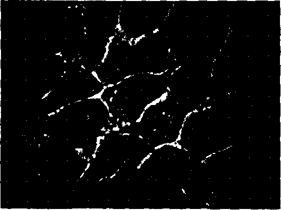 Human foetus pancreatic stem cell line and its establishing method