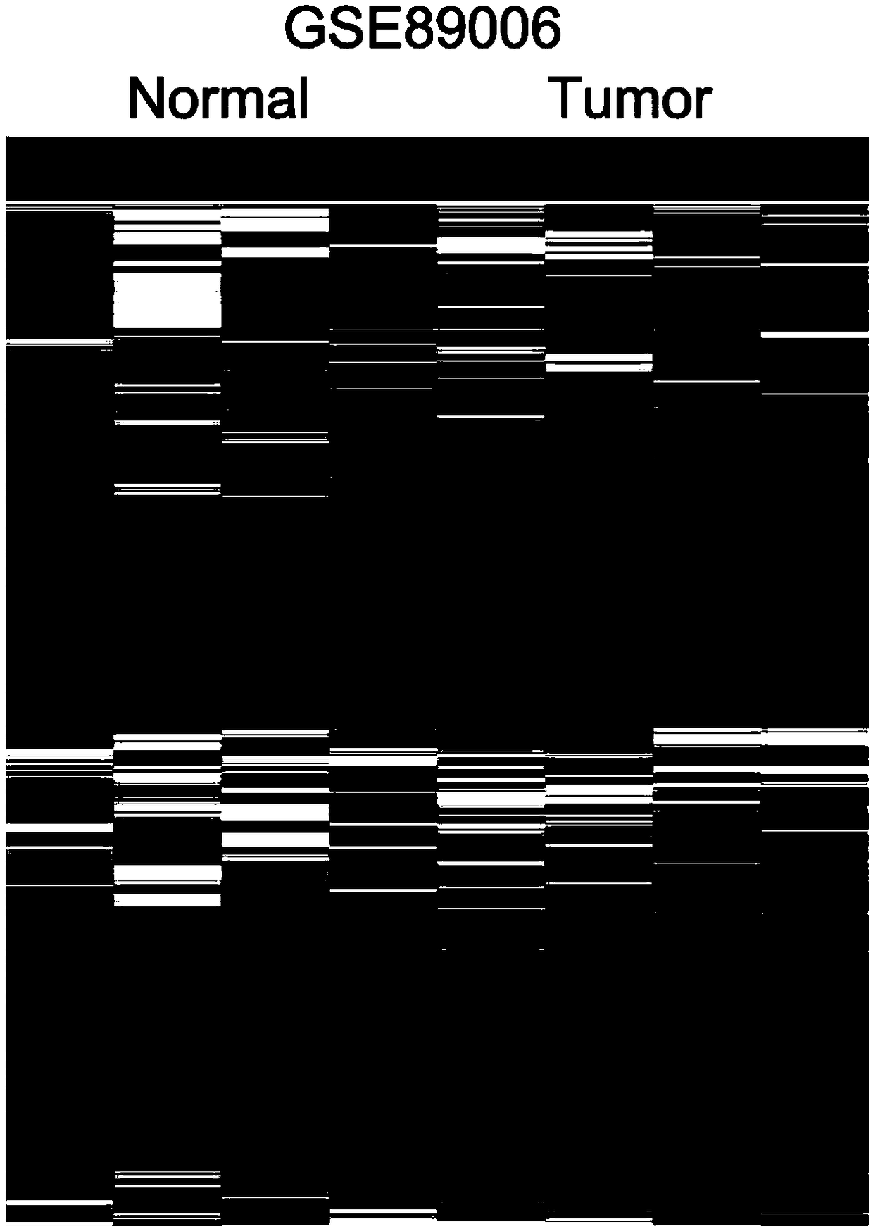 Application of long-chain non-coding RNA DUXAP8 as biomarker for prognosis of bladder cancer