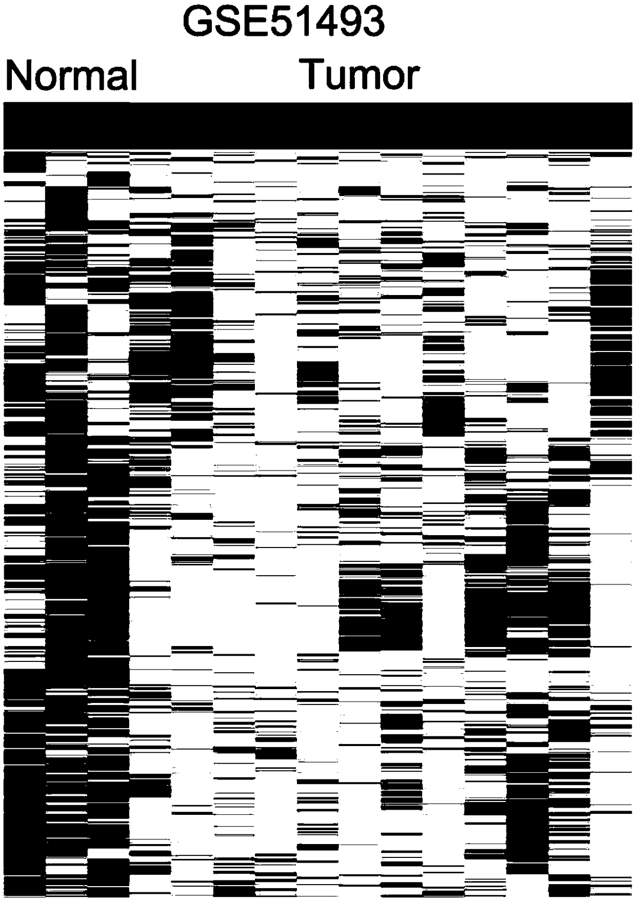 Application of long-chain non-coding RNA DUXAP8 as biomarker for prognosis of bladder cancer