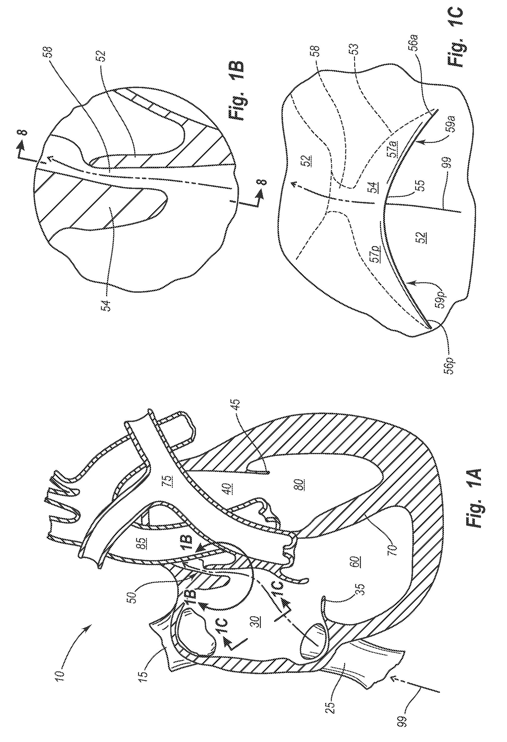 Devices for reducing the size of an internal tissue opening