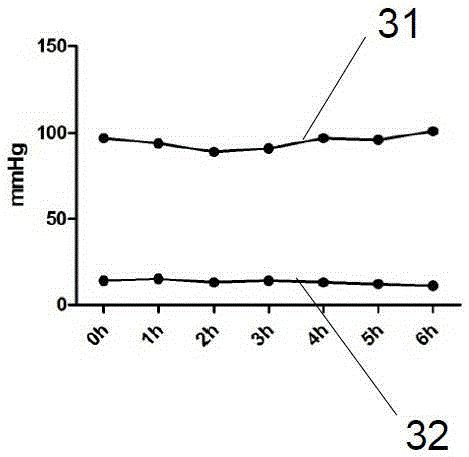 Liver normal temperature perfusion restoration system