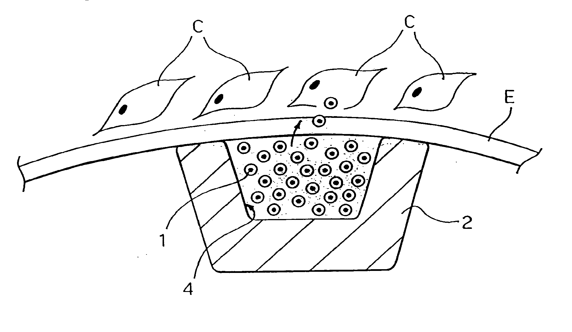 Carrier and kit for intraluminal delivery of active principles or agents