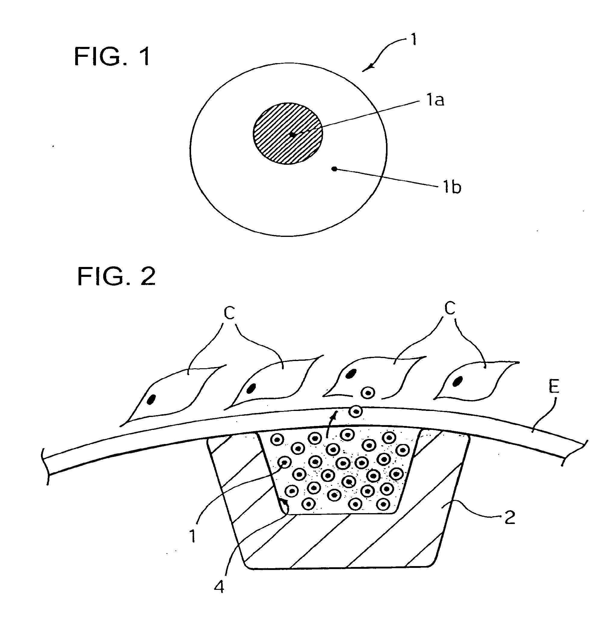 Carrier and kit for intraluminal delivery of active principles or agents