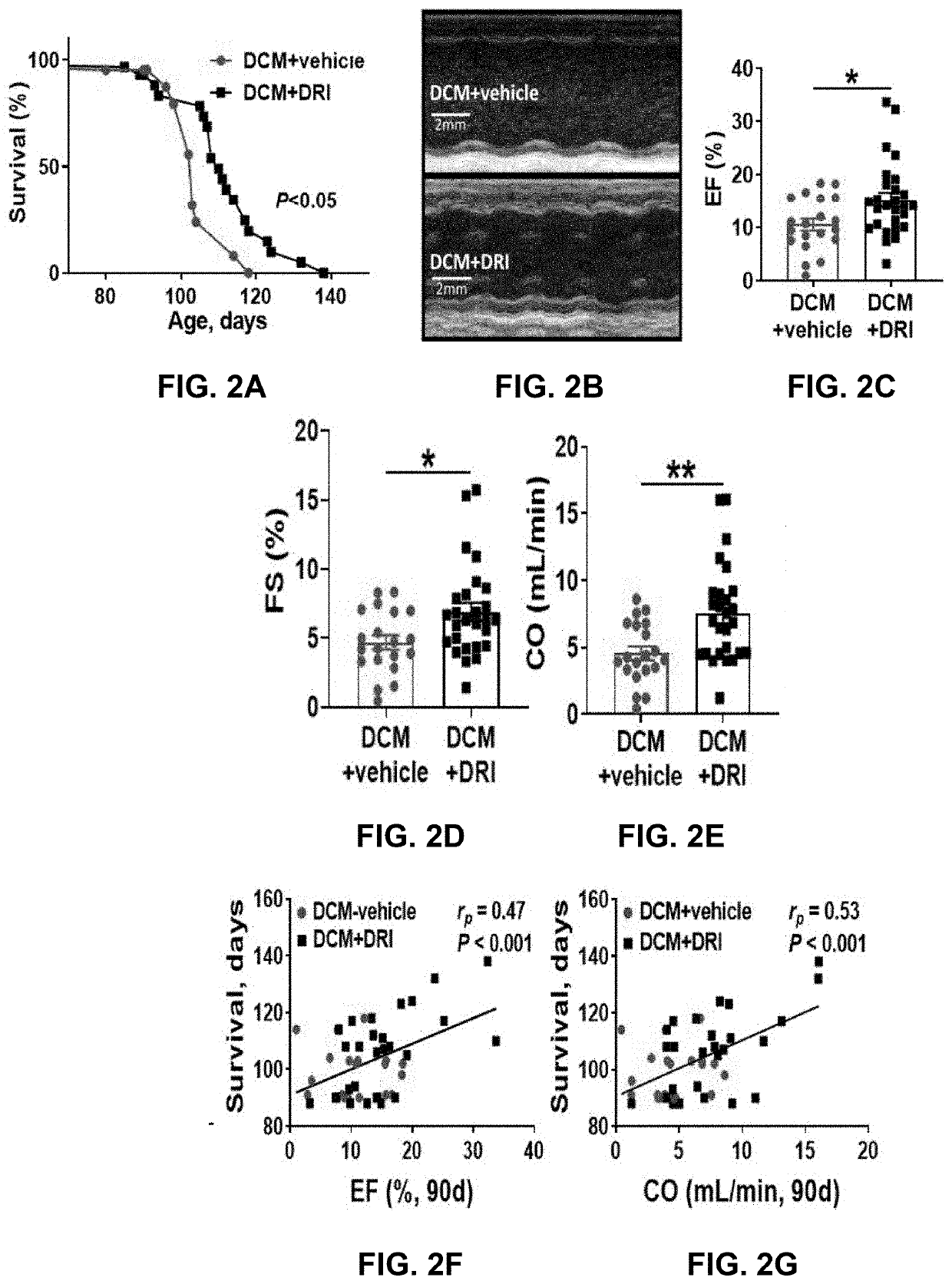 Method of personalized treatment for cardiomyopathy and heart failure and other related diseases by measuring renin activity, pro-renin, pro-renin receptor levels in blood