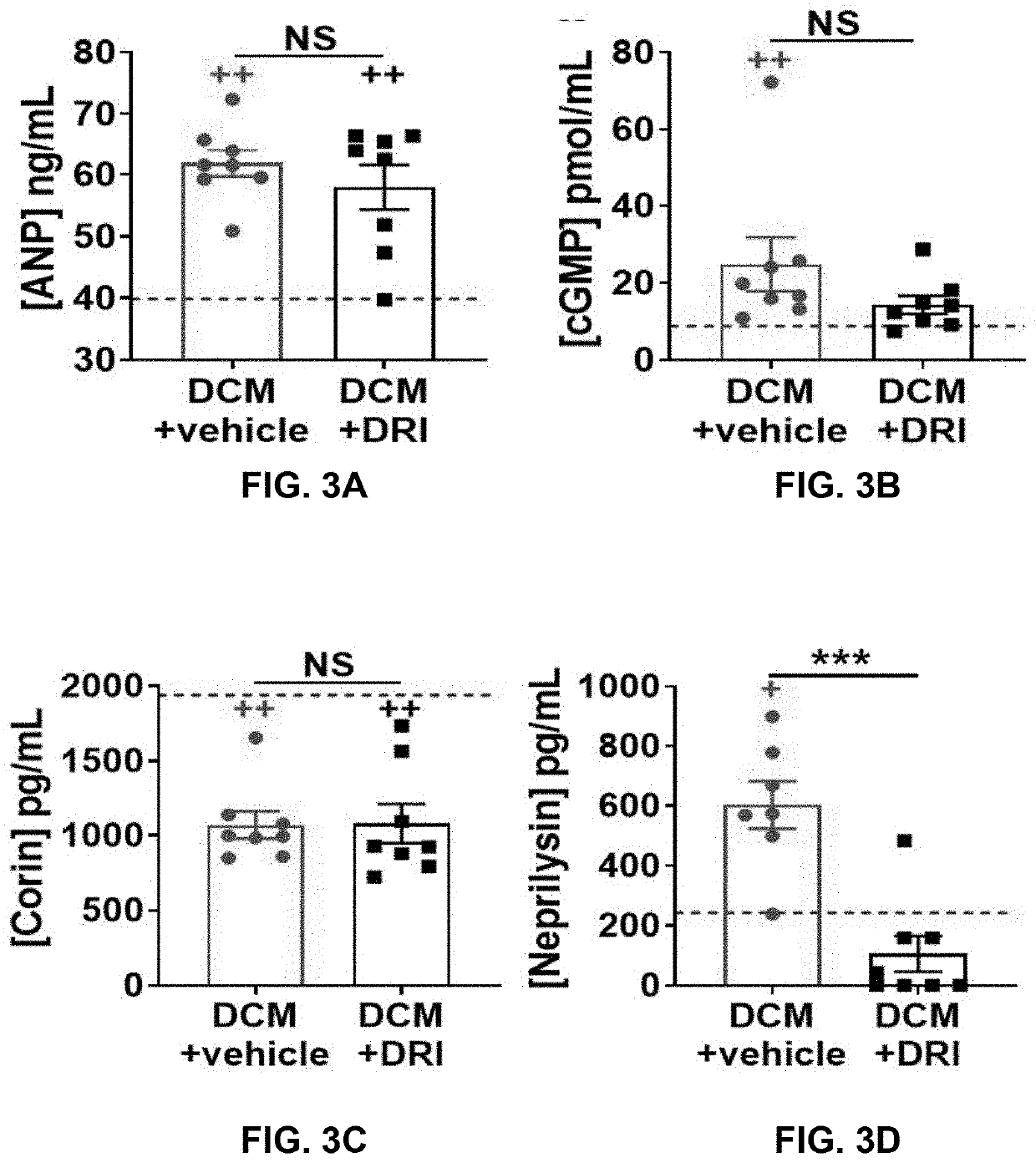 Method of personalized treatment for cardiomyopathy and heart failure and other related diseases by measuring renin activity, pro-renin, pro-renin receptor levels in blood