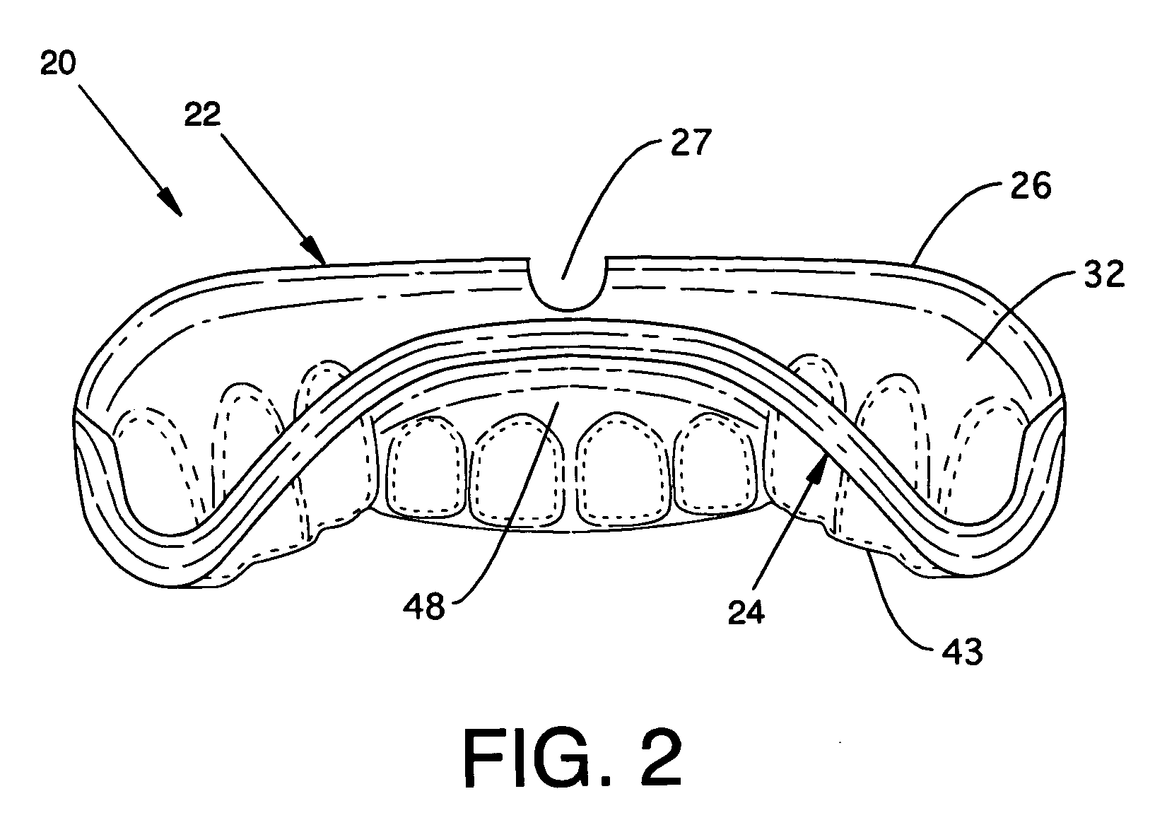 Custom mouthguard