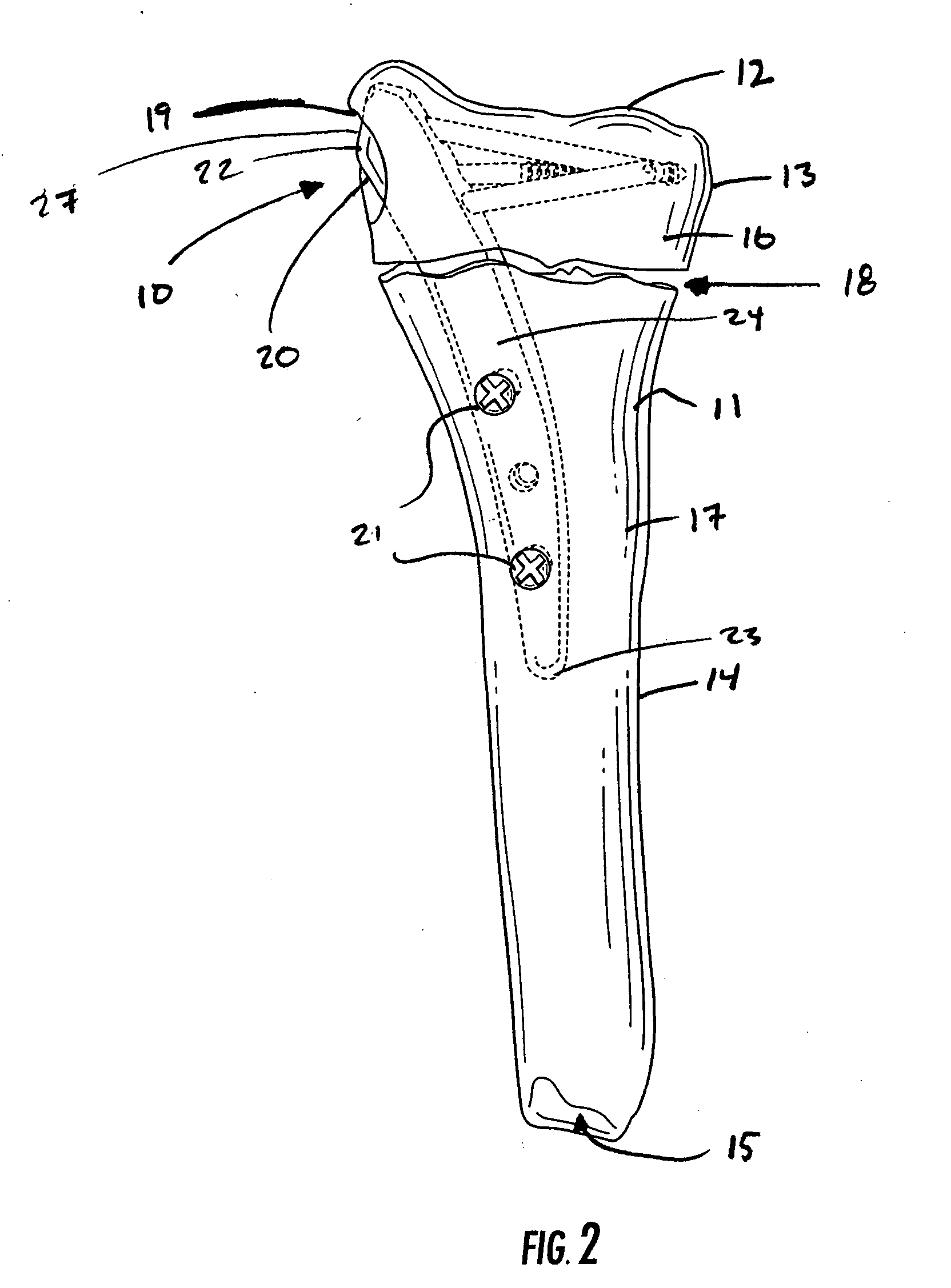 Intramedullary fixation assembly and devices and methods for installing the same