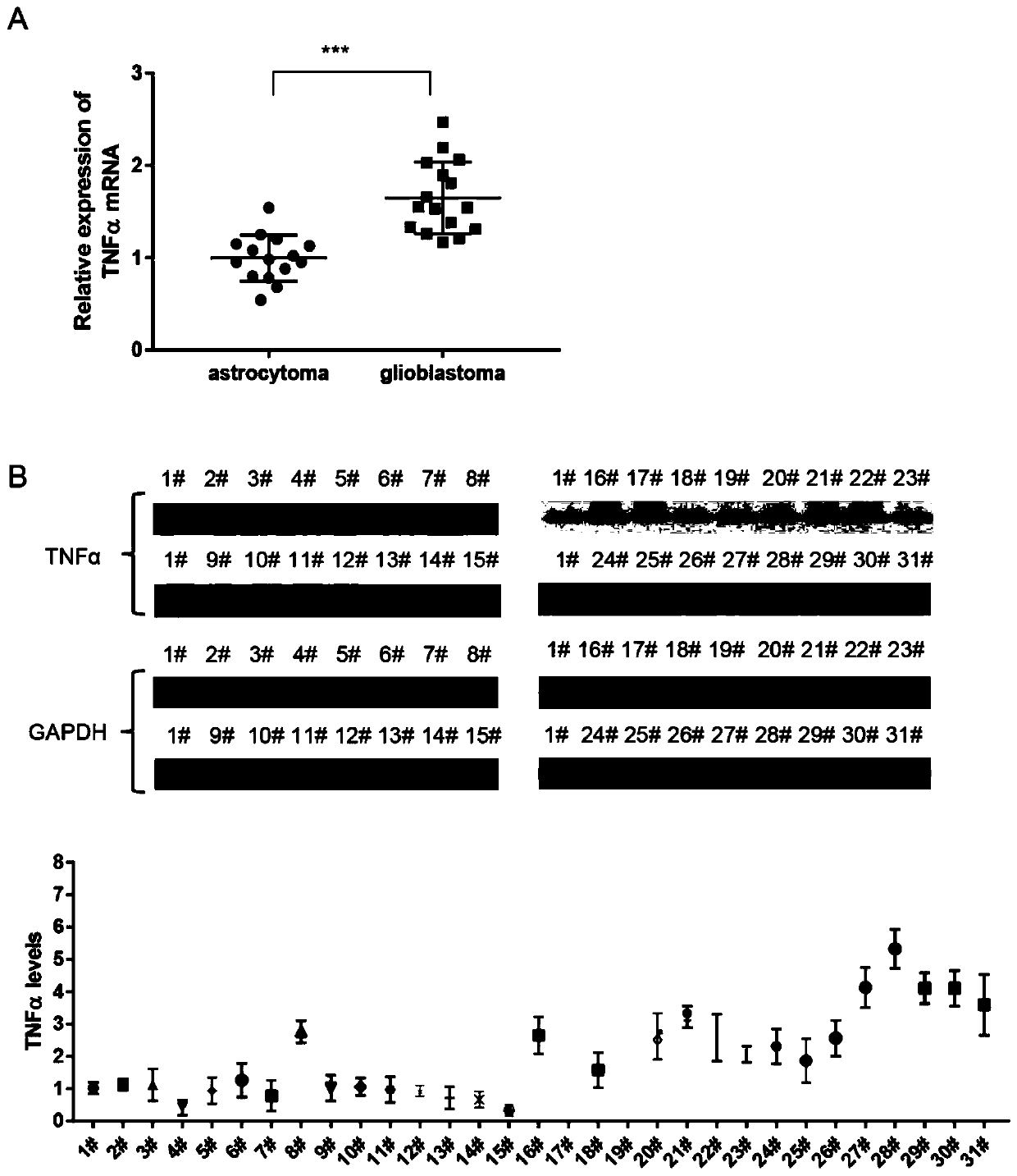 Application of TNF alpha micromolecule inhibitor C87 to preparation of medicines for treating glioma