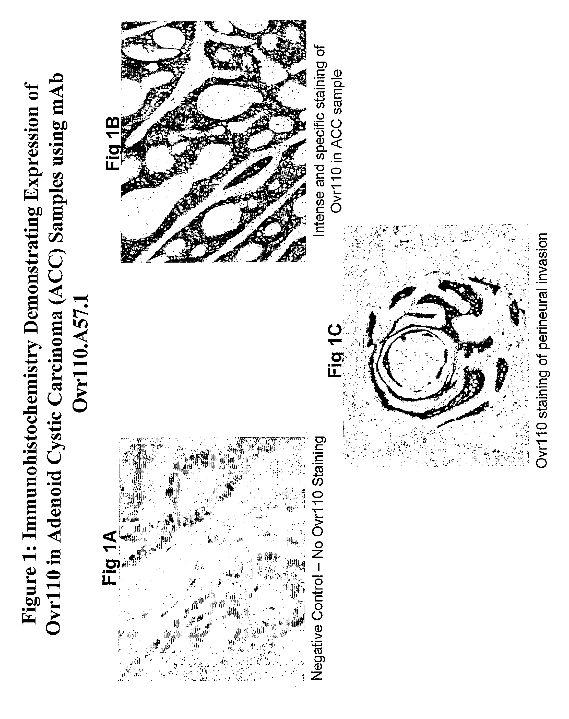 Ovr110 antibody compositions and methods of use