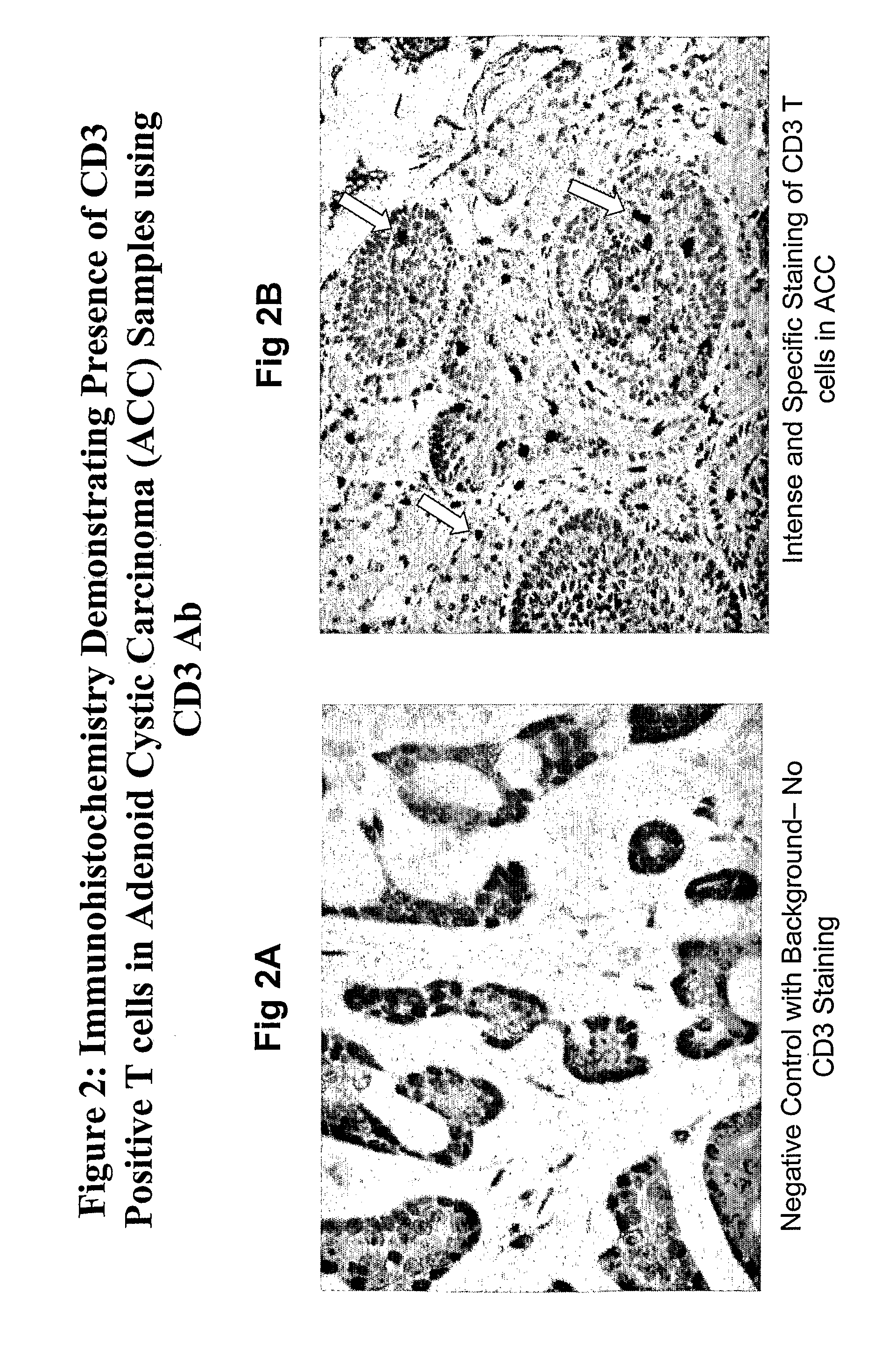 Ovr110 antibody compositions and methods of use