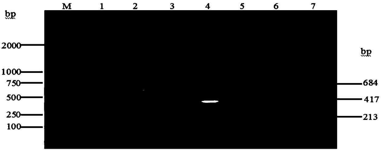 Primer set, reagent kit and method for detecting canine distemper viruses, canine parvoviruses and canine coronaviruses