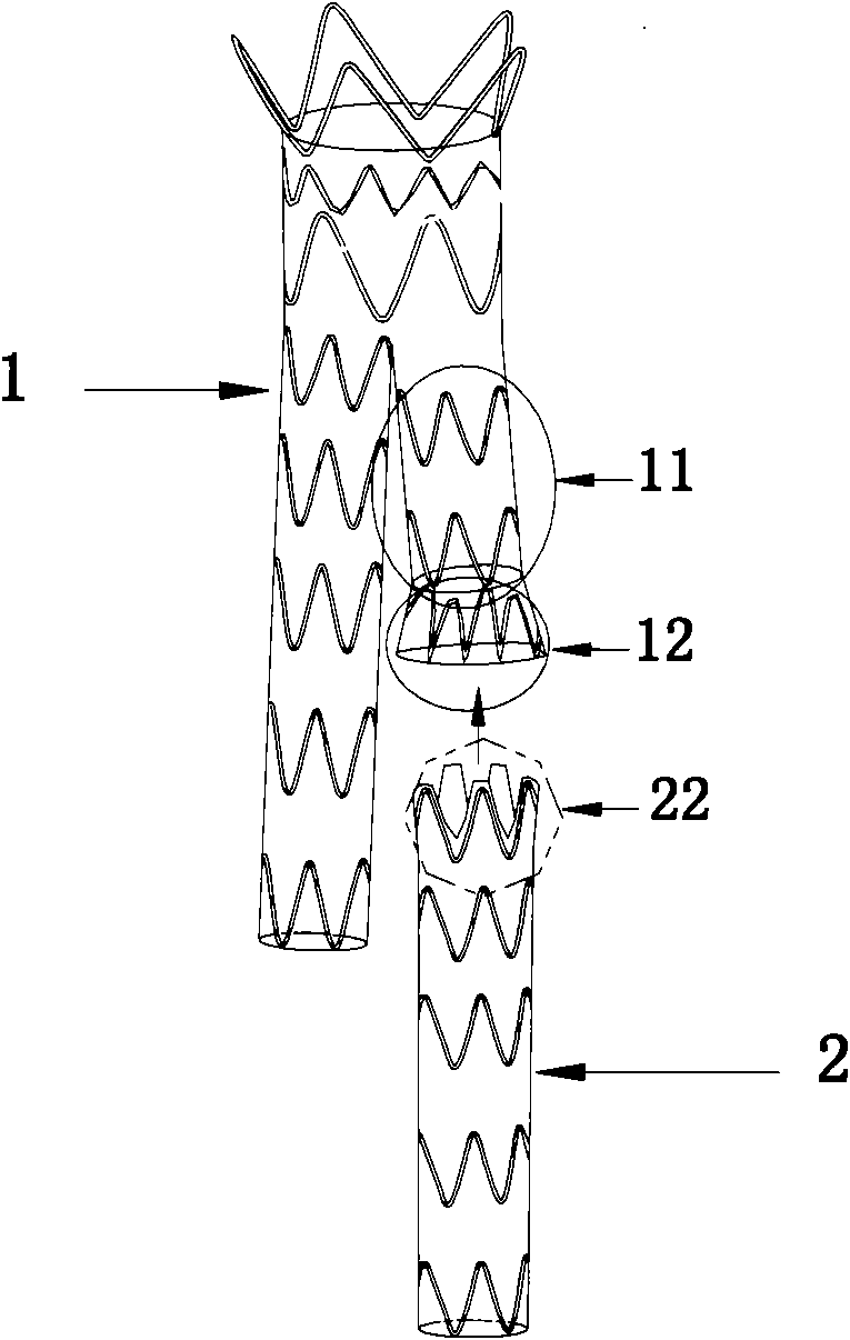 Furcated intravascular stent