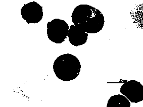 Human acute B lymphocyte leukemia cell line and application thereof