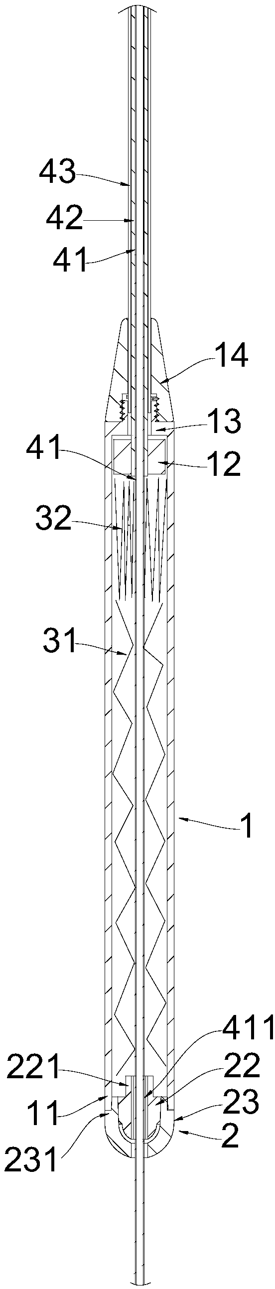 Gastric deflector