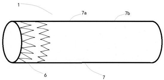 A new type of vascular assembly with branched stent-graft in the aortic arch