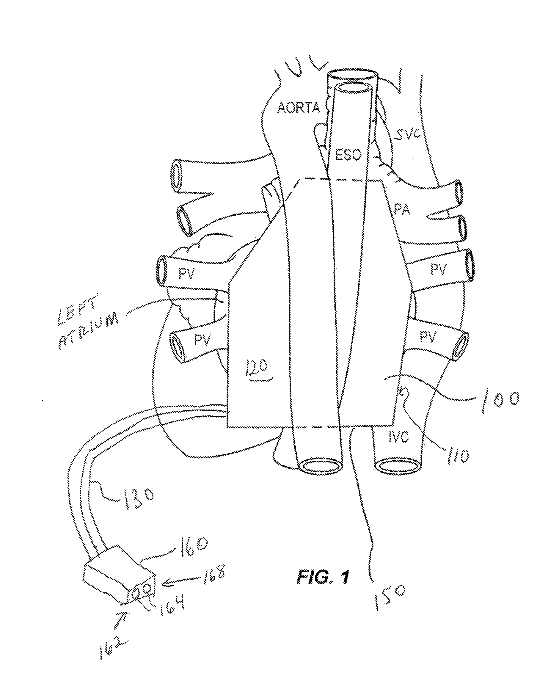 Indifferent electrode pad systems and methods for tissue ablation