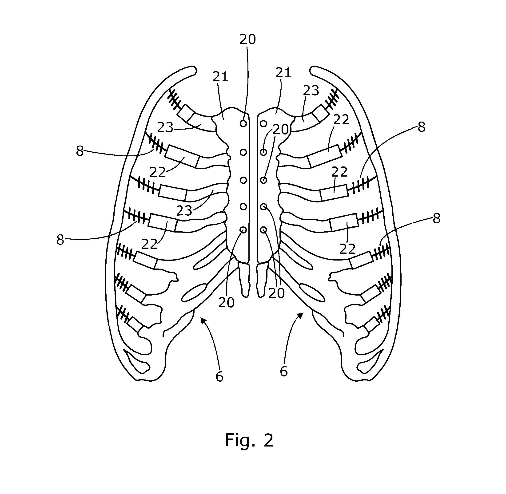 Simulation apparatus