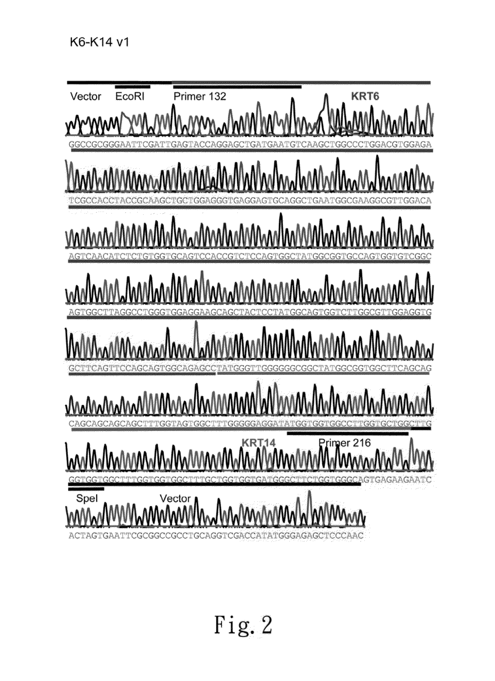 Method for in vitro detecting keratin gene fusion of squamous-cell cancer