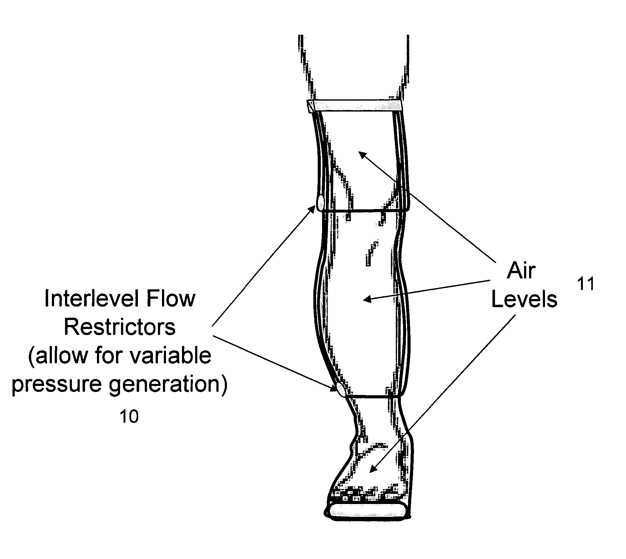 Method and apparatus for treating wound using negative pressure therapy