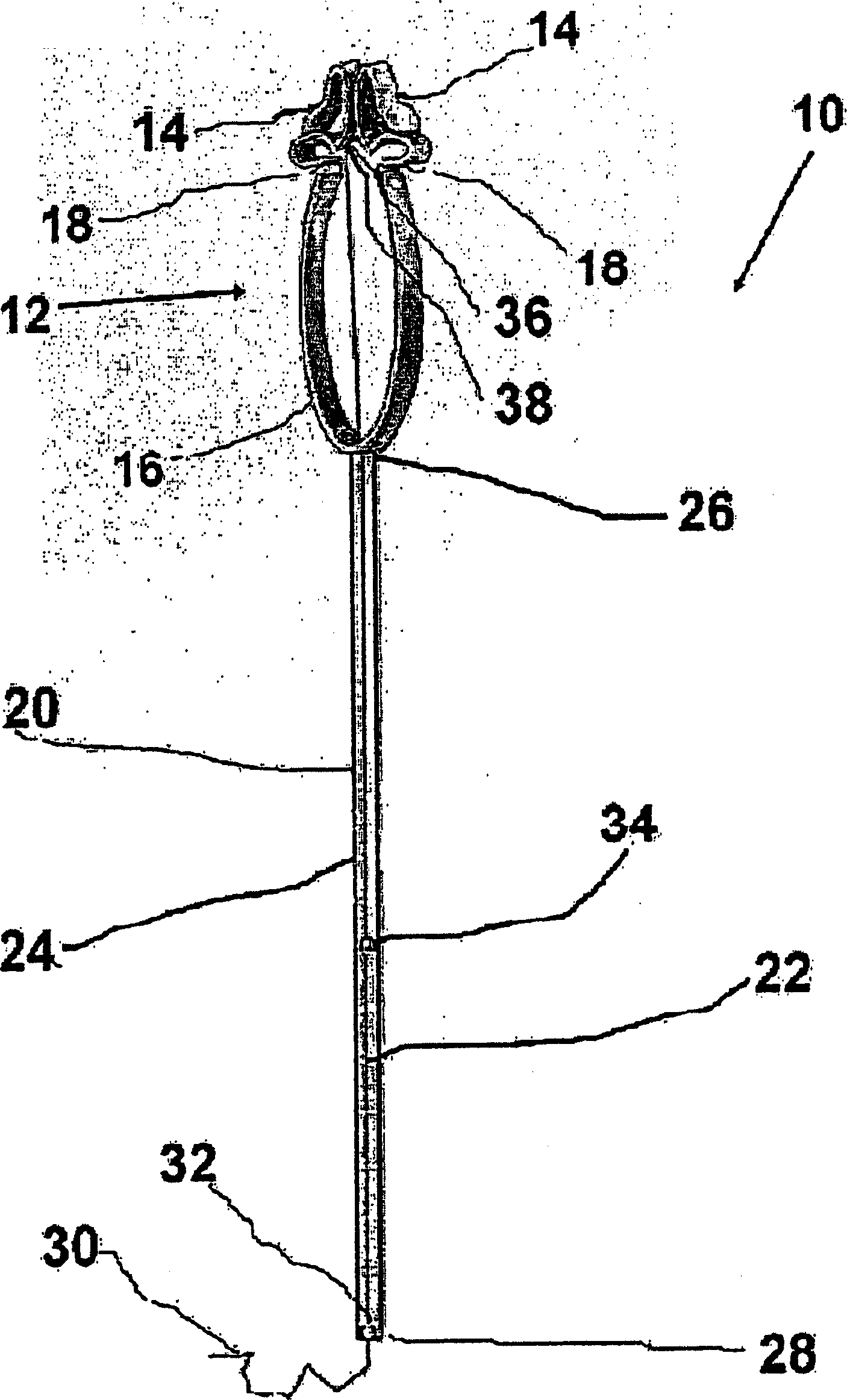 Cervical dilation monitor