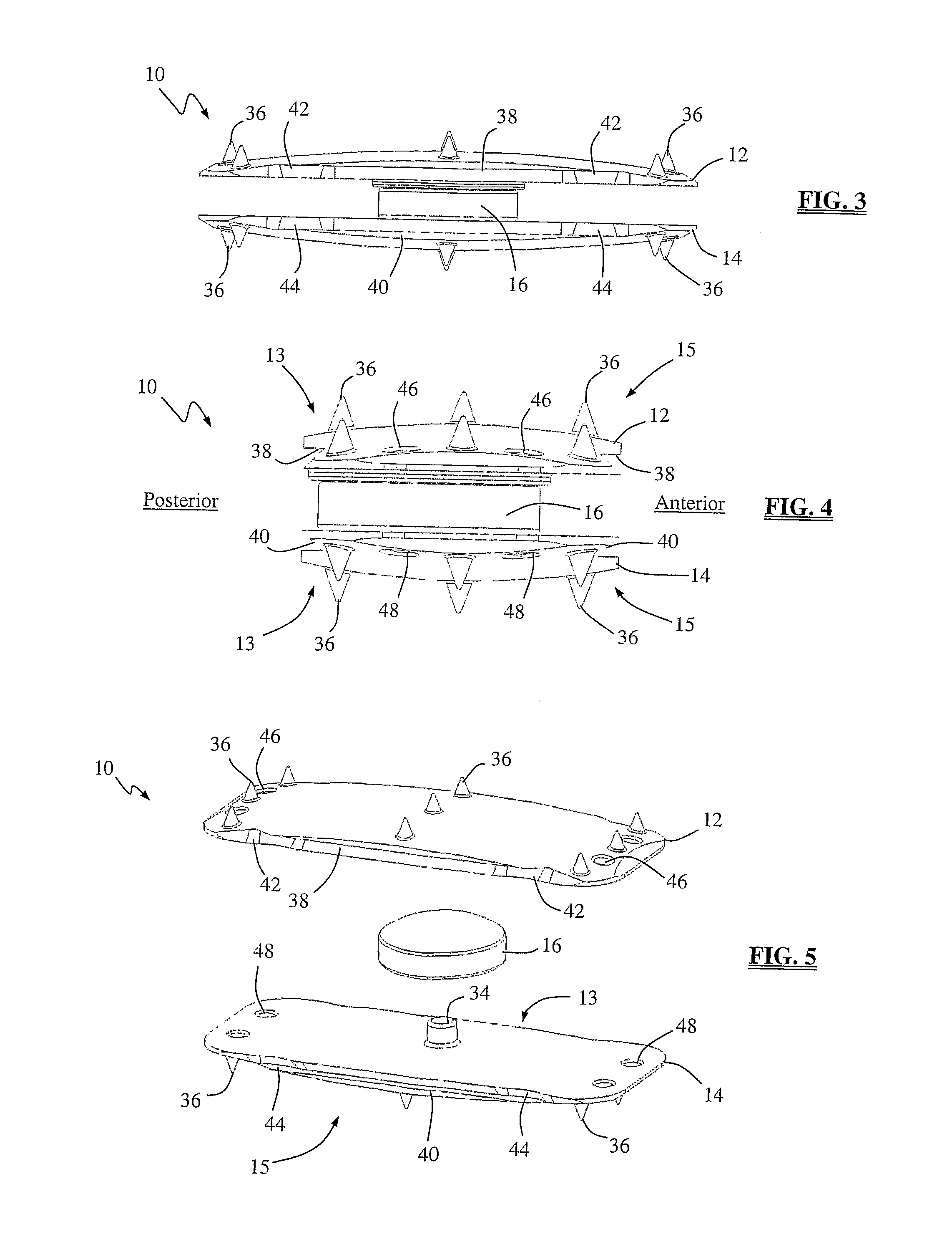 Total disc replacement system and related methods