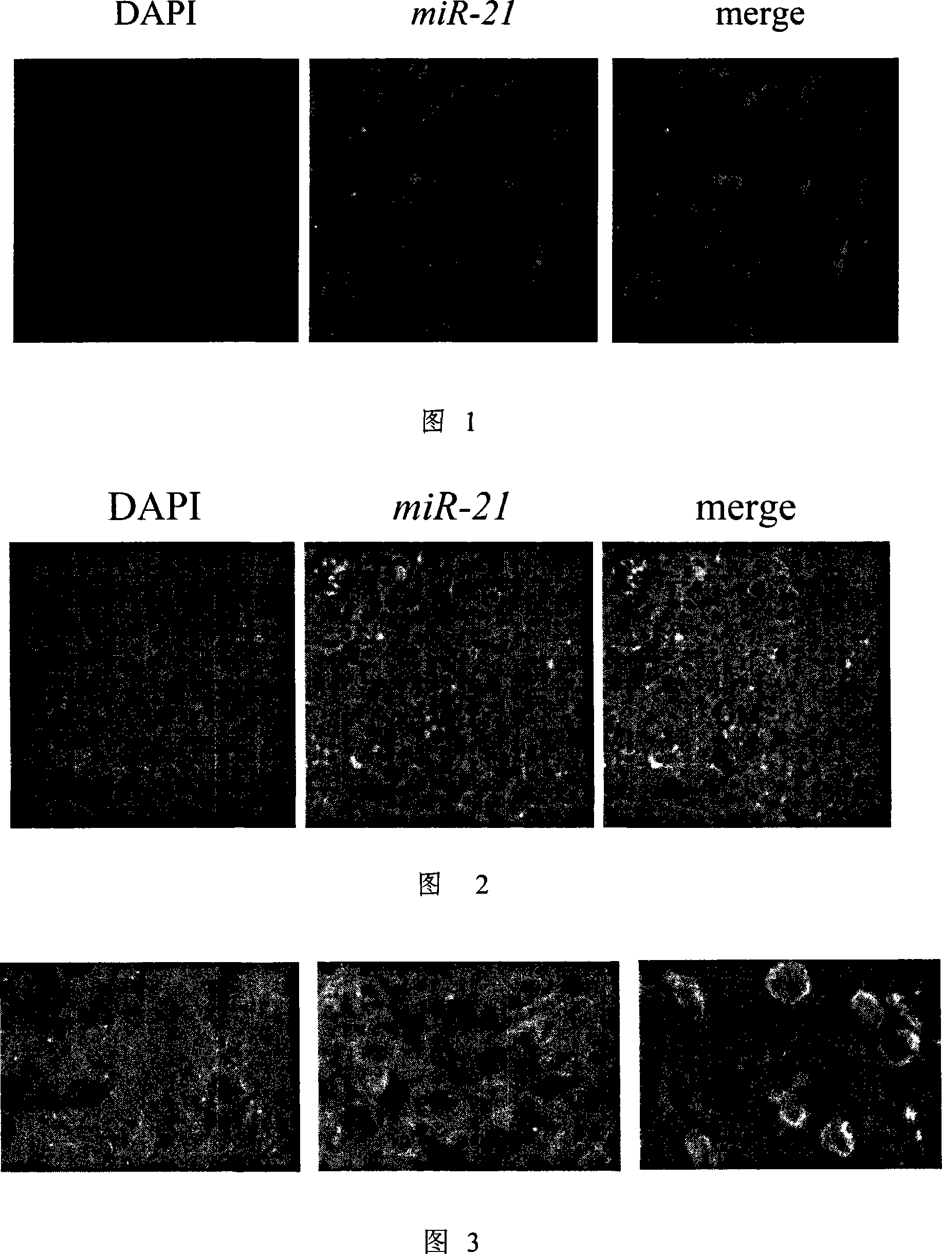 In-situ combination detection method for miRNA expression and cell apoptosis