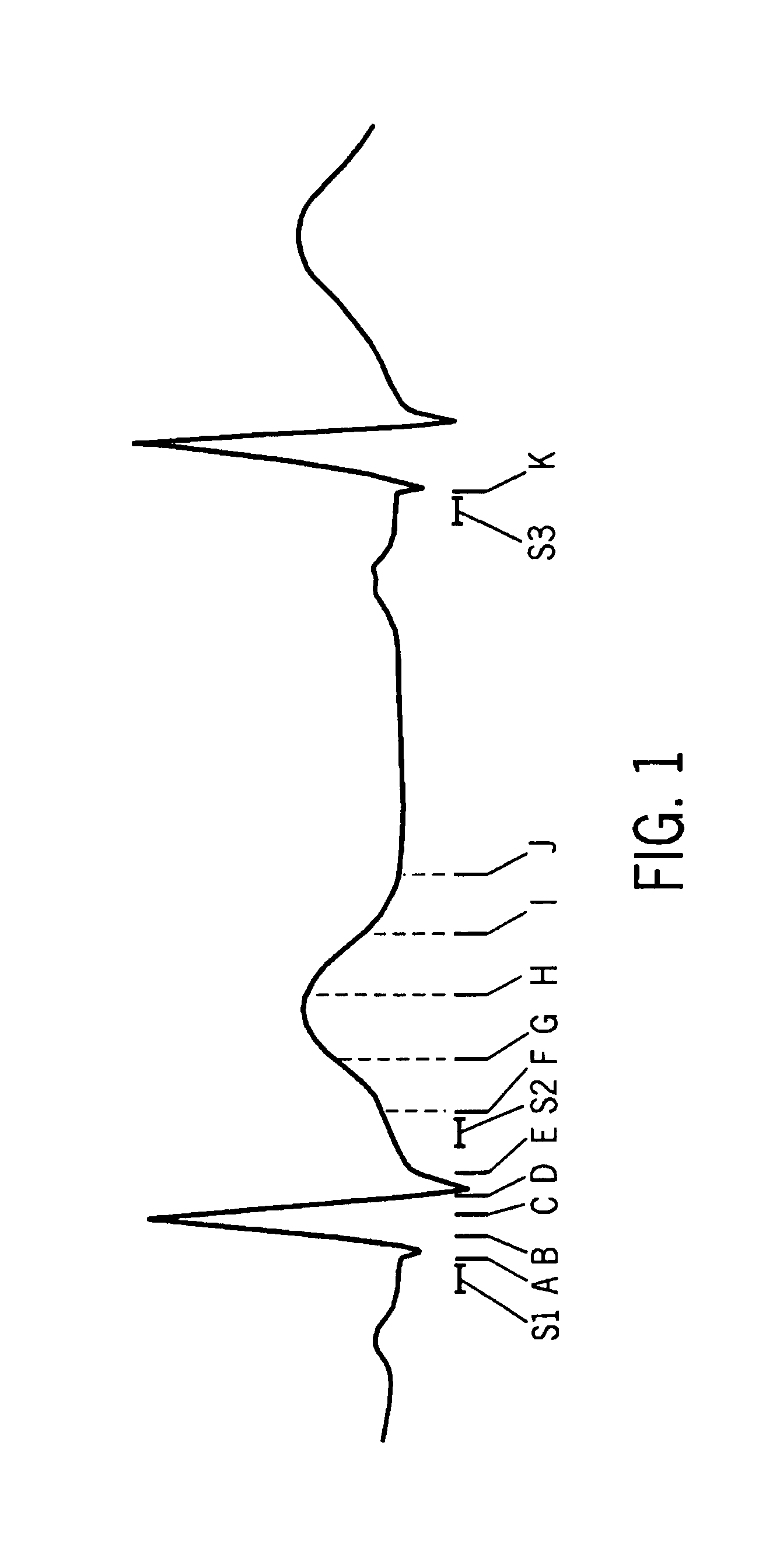 Method and apparatus to optimally measure cardiac depolarization/repolarization instability