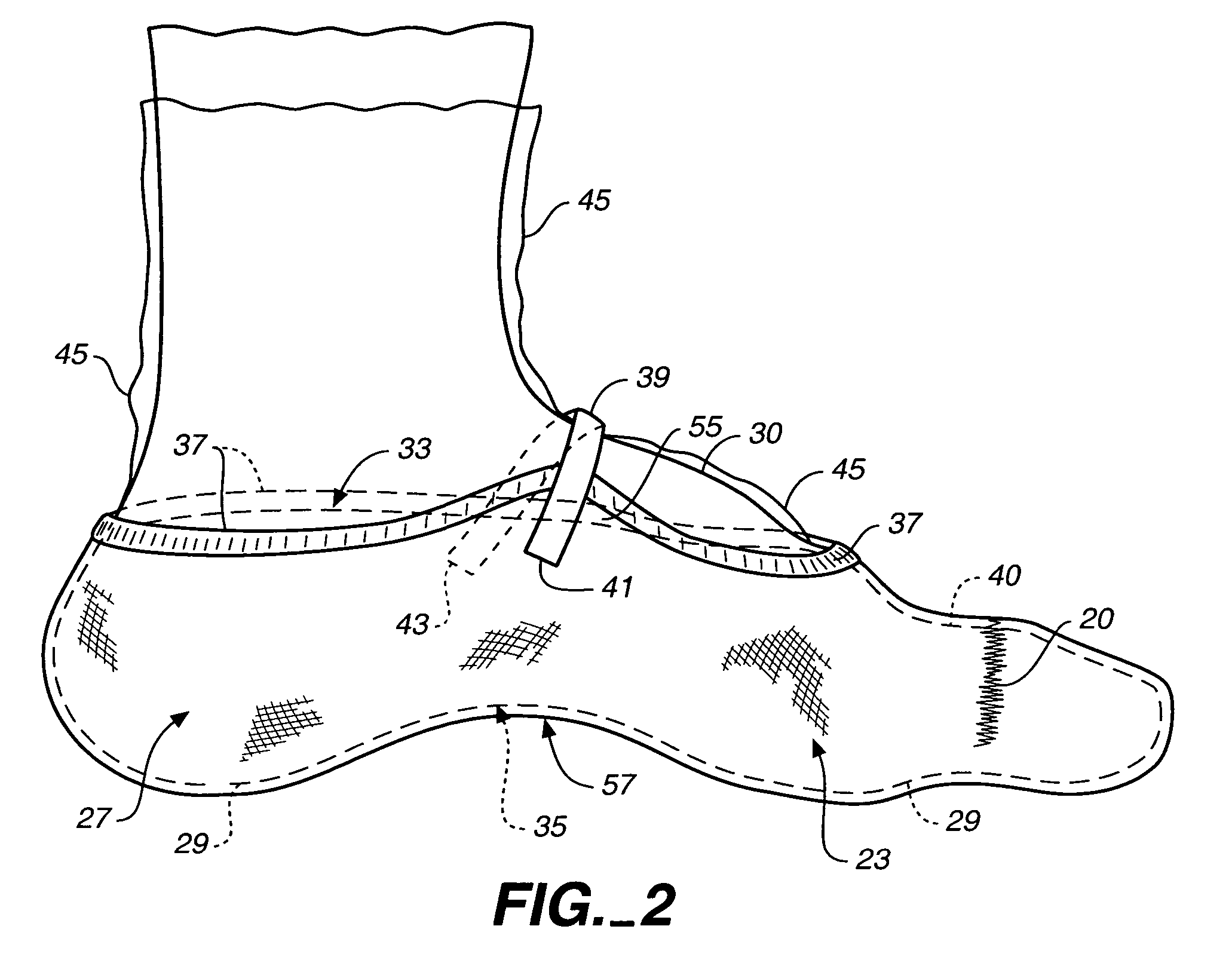 Orthopedic casting slipper kit and method