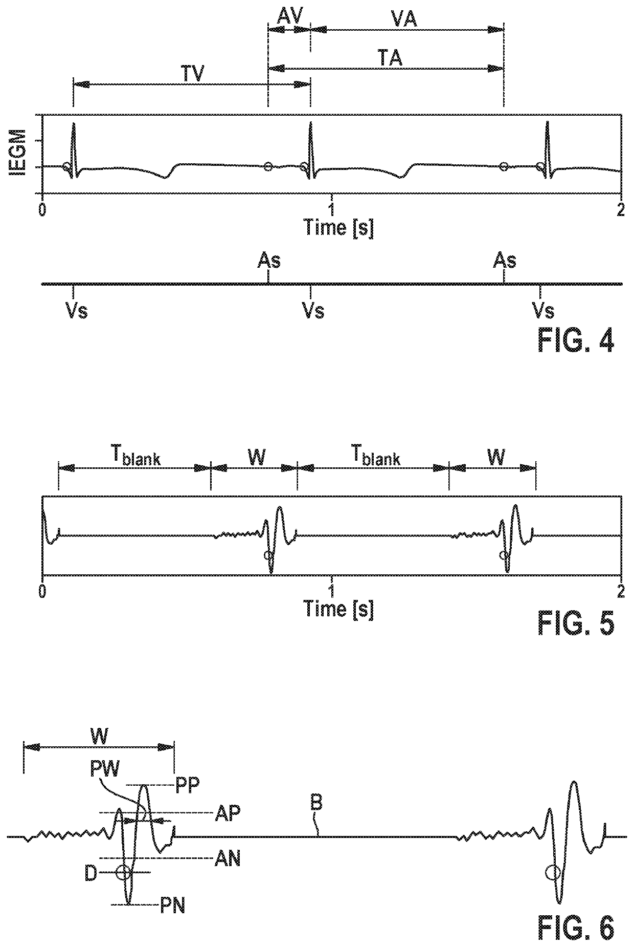 Leadless cardiac pacemaker device configured to provide intra-cardiac pacing