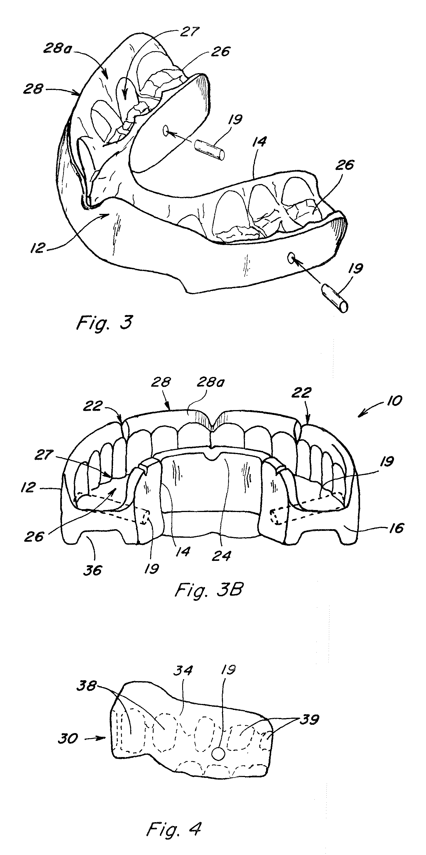 Dental bite construction for performance enhancing mouth guards