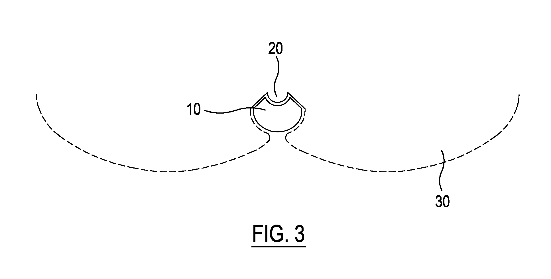 Hemorrhoid Pressure Relief Device