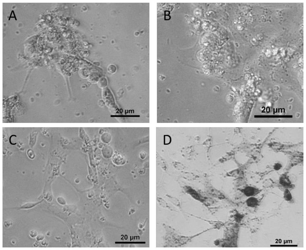 Hexagrammos otakii spermatogonium culture medium and culture method