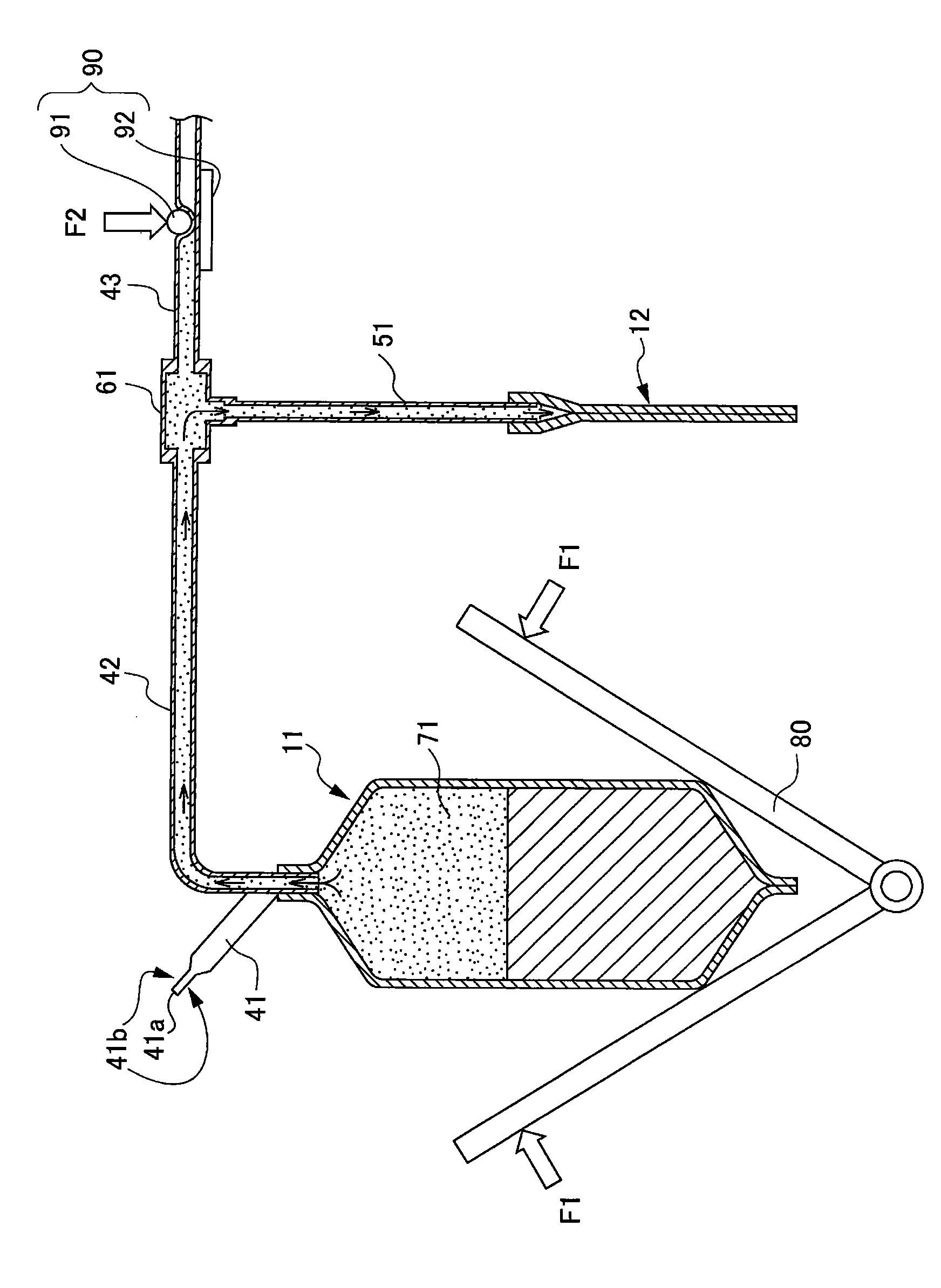 Serum preparation method and serum preparation apparatus