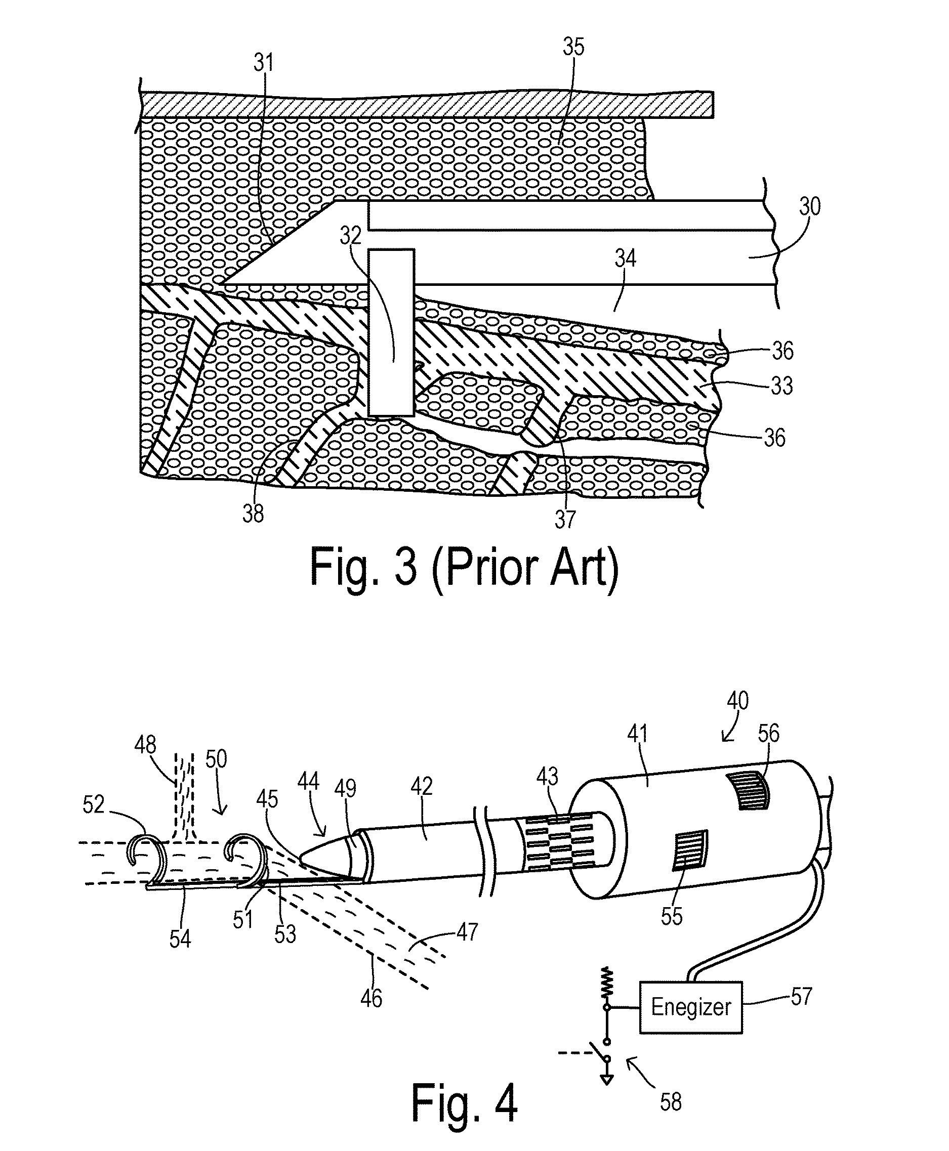 Endoscopic vessel harvester with blunt and active dissection
