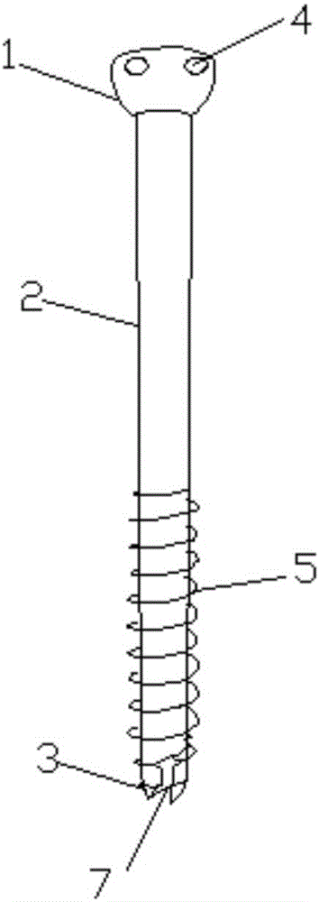 Hollow screw for restoring damaged ligaments or muscle tendons