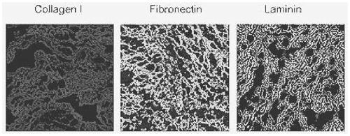 Preparation method of thermally responsive bladder extracellular matrix bioactive hydrogel