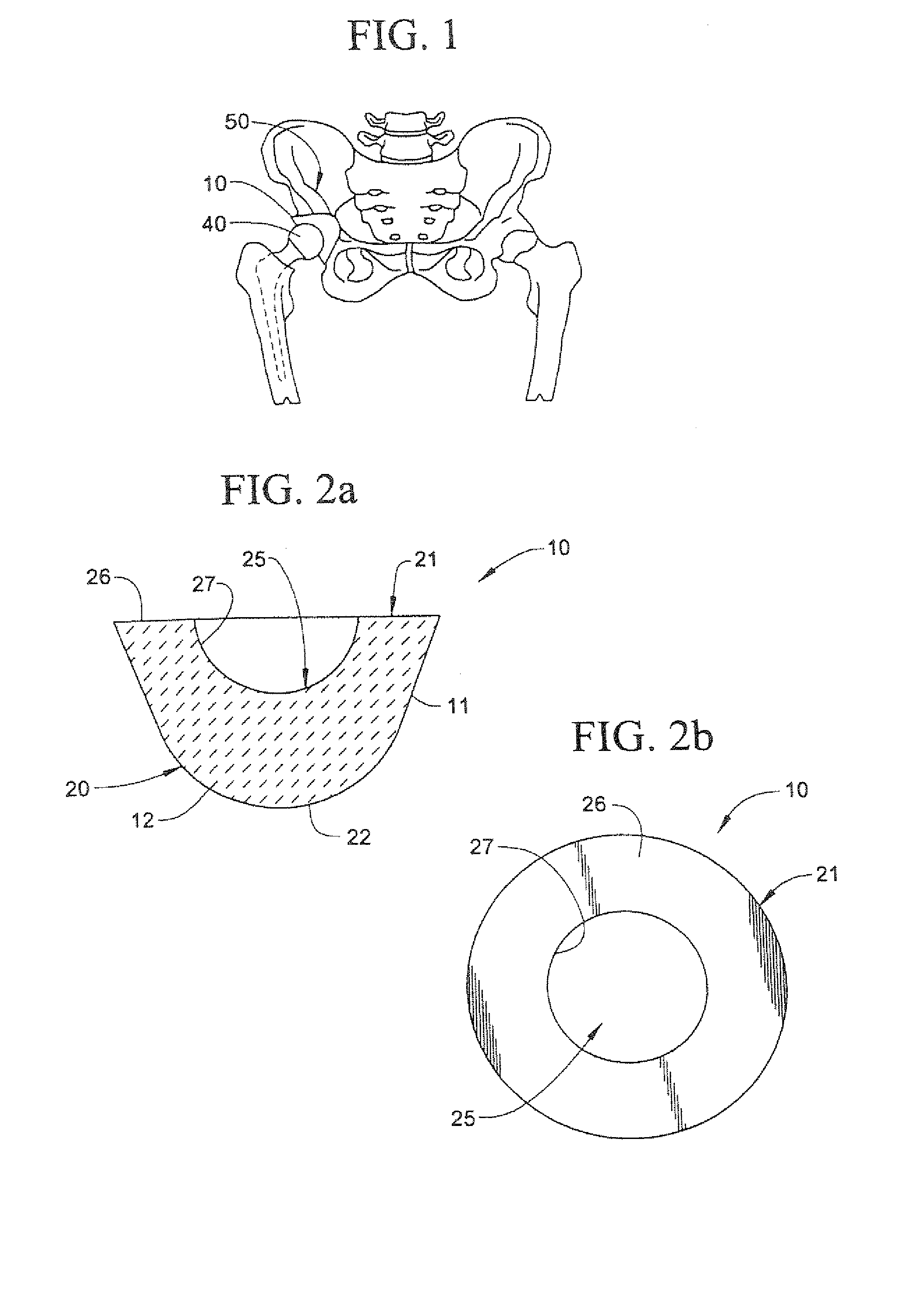 Acetabular component of total hip replacement assembly