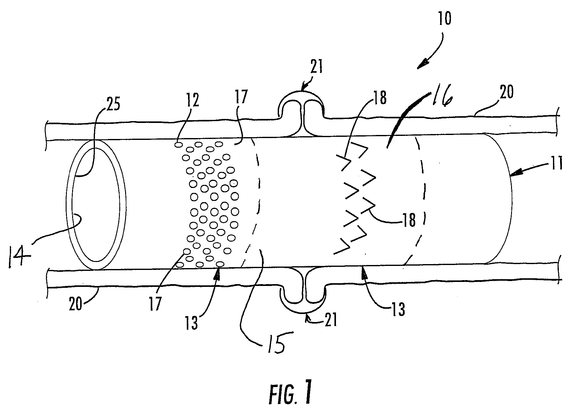 Gastro-intestinal therapeutic device and method