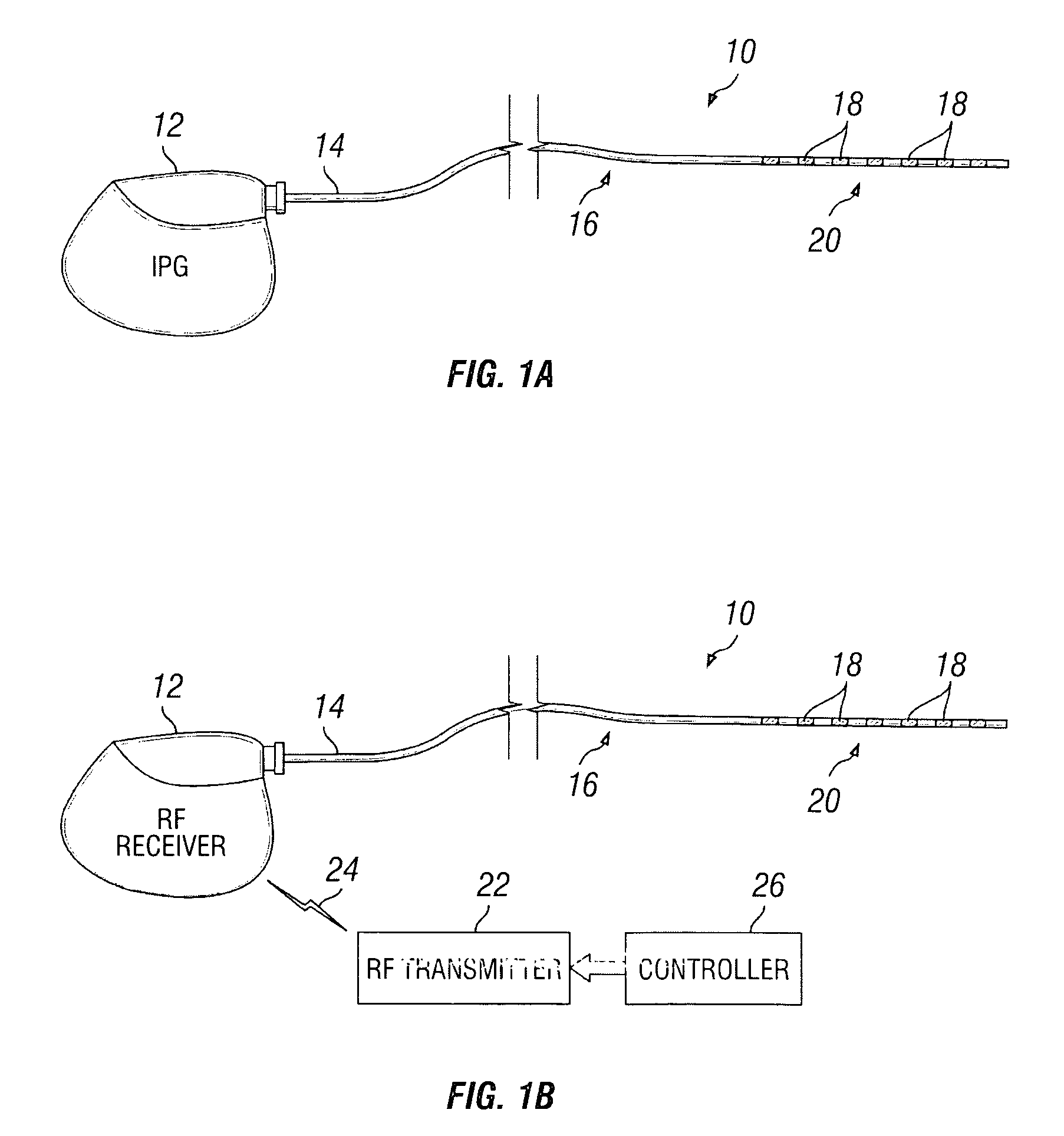 Stimulation system and method for treating a neurological disorder