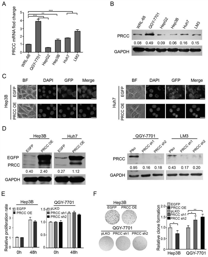 Application of PRCC or up-regulation agent thereof in liver cancer treatment and application of PRCC in liver cancer diagnosis or prognosis