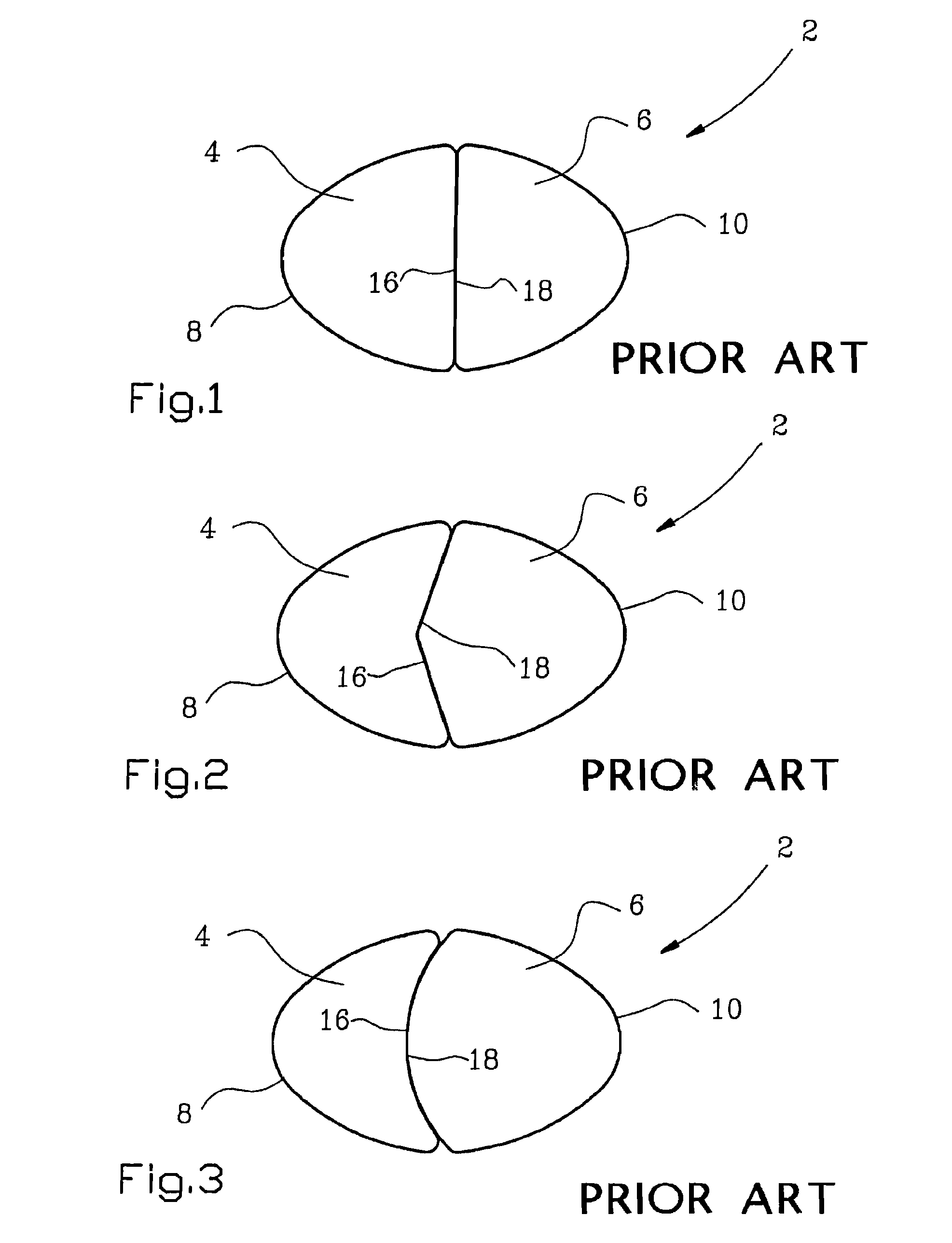 Mounting device for orthodontic retainer elements and a method of maintaining said elements in place for mounting on corresponding teeth