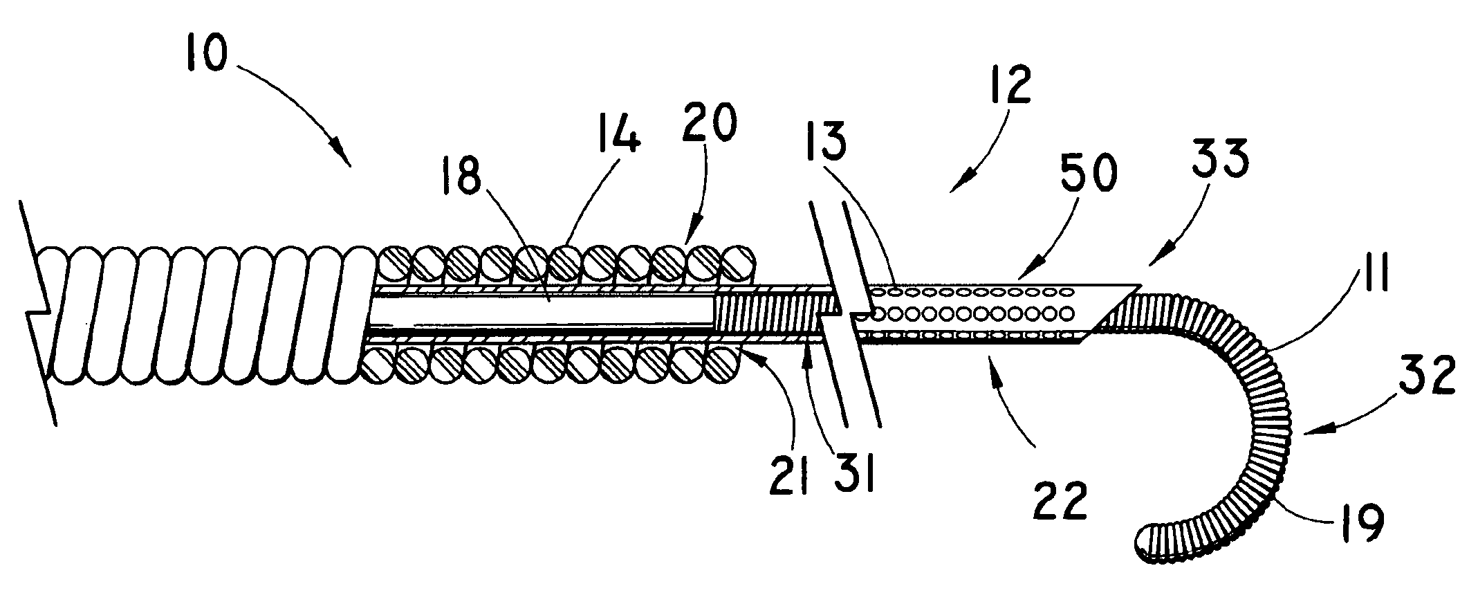 Method and apparatus for augmentation of a sphincter