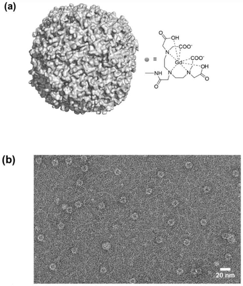 Tumor targeting gadolinium-based magnetic resonance imaging contrast agent and preparation method thereof