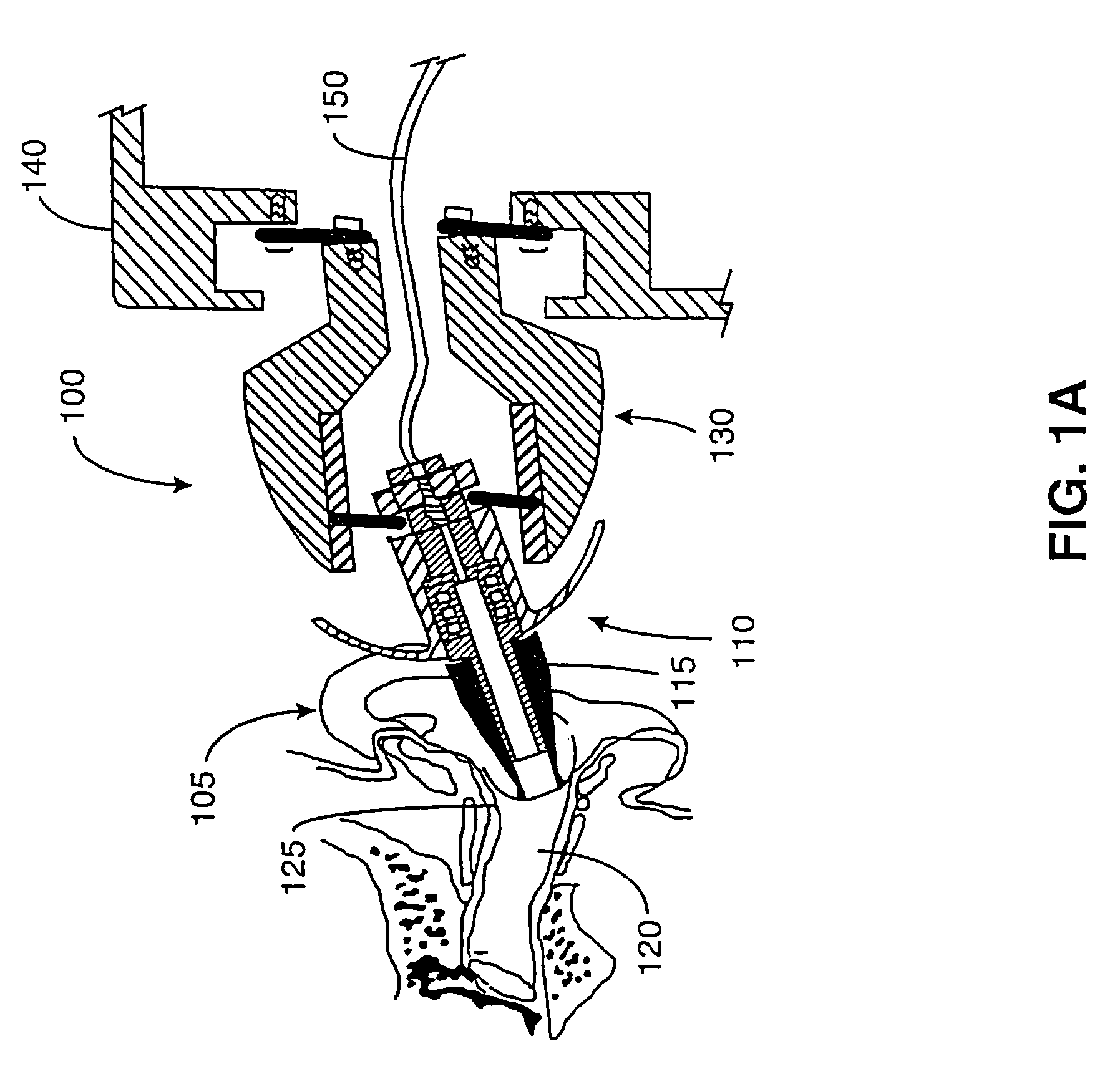 Hand-held hearing screener apparatus